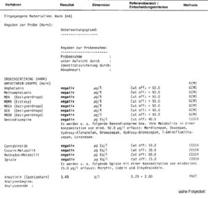 Buy urine test / proof of abstinence